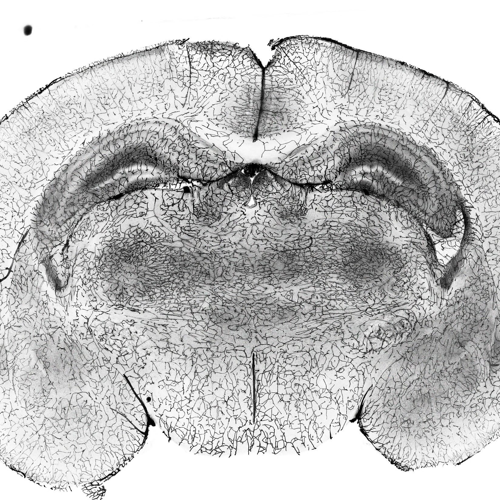 brain coronal section